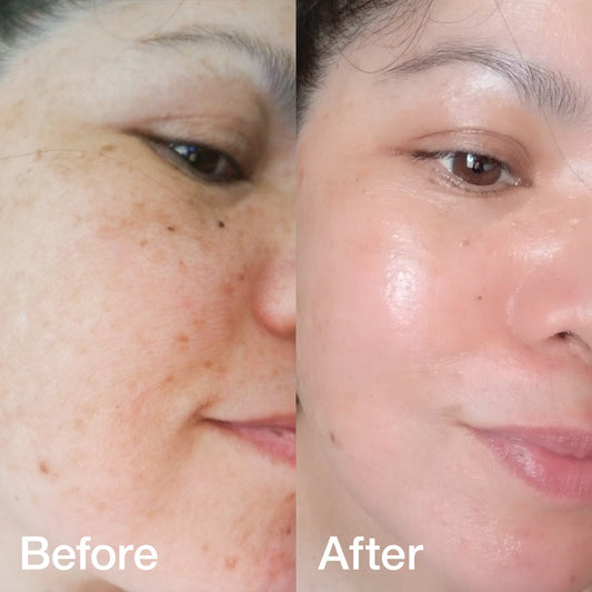 Collagen Booster Set