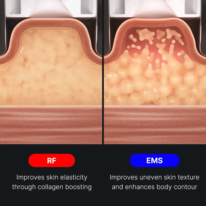 AGE-R Contour Body Shot | Medicube US